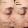 Shiseido Future Solution LX Eye and Lip Contour Regenerating Cream Refill – 17 mL – Visibly Improves the Look of Wrinkles & Sagging Around the Eyes and Mouth – All Skin Types