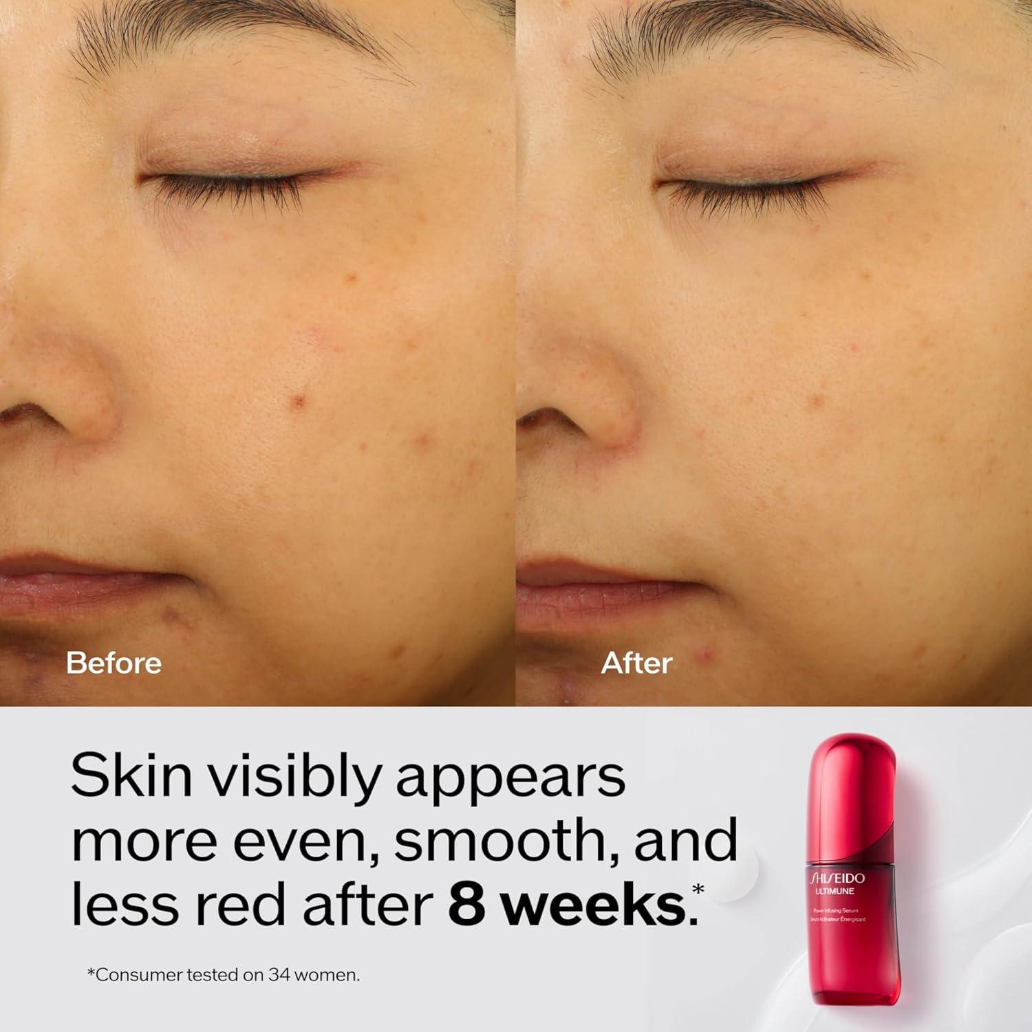 imageShiseido Brighten ampamp Nourish Cream Set Clarifying Cleansing Foam 50mL Ultimune Power Infusing Serum 10mL ampamp White Lucent Brightening Gel Cream 50mL 117 Value