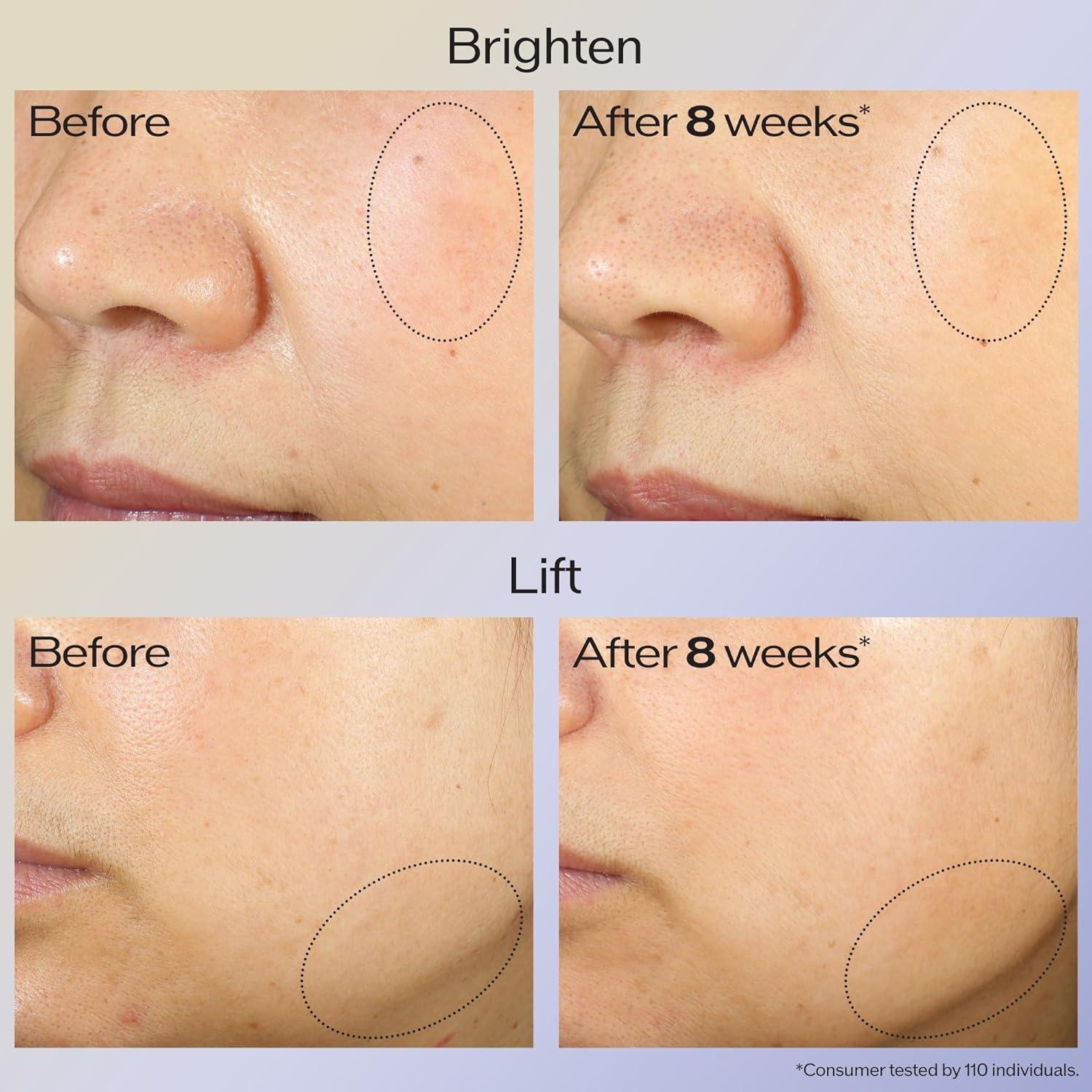image:imageShiseido Lifting amp Firming Eye Care Set Eudermine Activating Essence 30mL Vital Perfection Uplifting and Firming Advanced Cream 15mL amp Eye Cream 15mL 159 Value