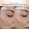 Shiseido Benefiance Dark Spot and Wrinkle Smoothing Face Serum – Visibly Improves Dark Spots & Wrinkles with Niacinamide & Plant-Based Retinol – 8HR Hydration – Non-Comedogenic, All Skin Types(1.69 Fl Oz (Pack of 1))