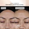 Shiseido Benefiance Dark Spot and Wrinkle Smoothing Face Serum – Visibly Improves Dark Spots & Wrinkles with Niacinamide & Plant-Based Retinol – 8HR Hydration – Non-Comedogenic, All Skin Types(1.69 Fl Oz (Pack of 1))